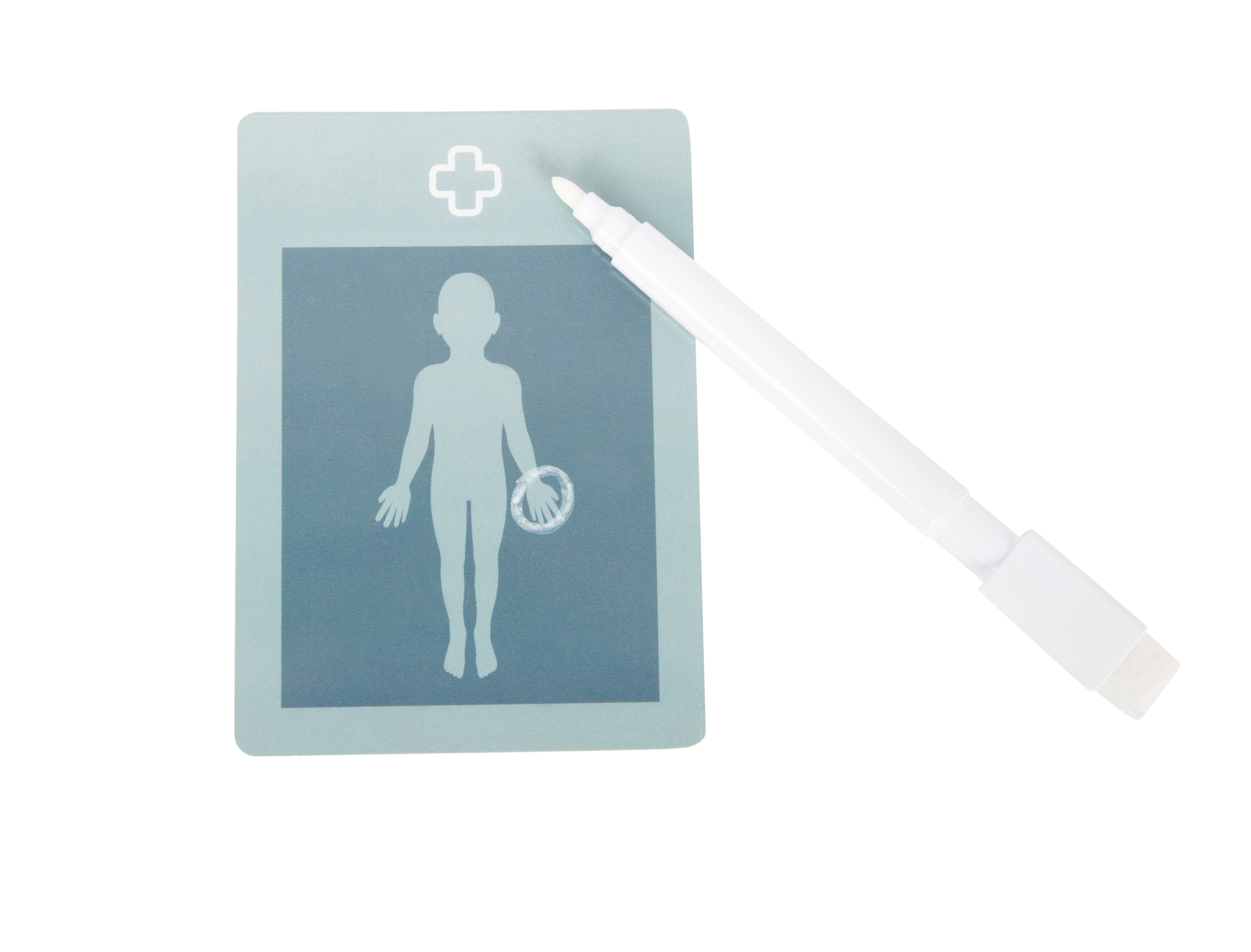 Körperabbildung auf Patientenkarte zum Verletzung einkreisen
